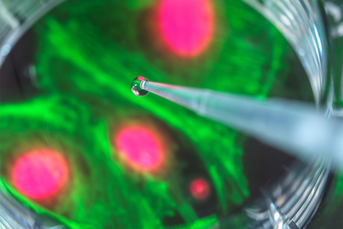 Dropper over a petri dish